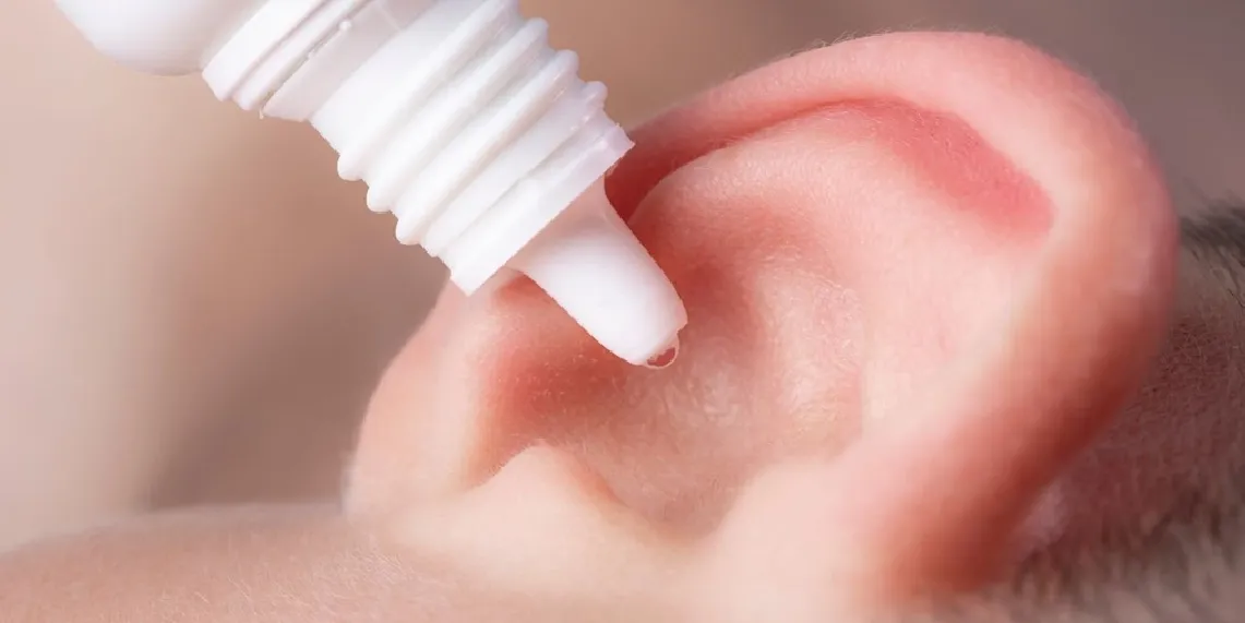 Antibiotic ear drops being applied to inflamed outer ear showing standard swimmer_s ear treatment.webp