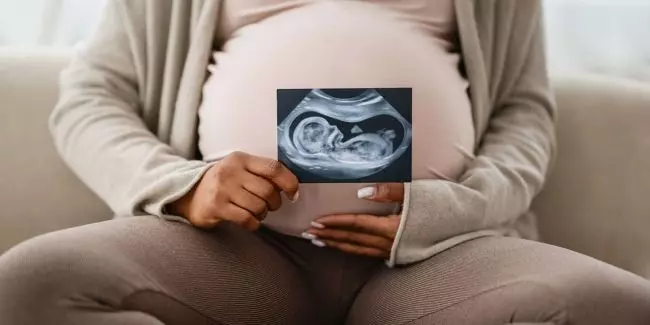 Northwest Family Clinics - 20-Week Anatomy Scan