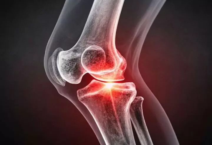 Knee joint inflammation during cold weather