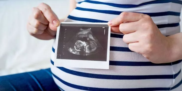 Pregnant woman holding baby ultrasound image from prenatal visit