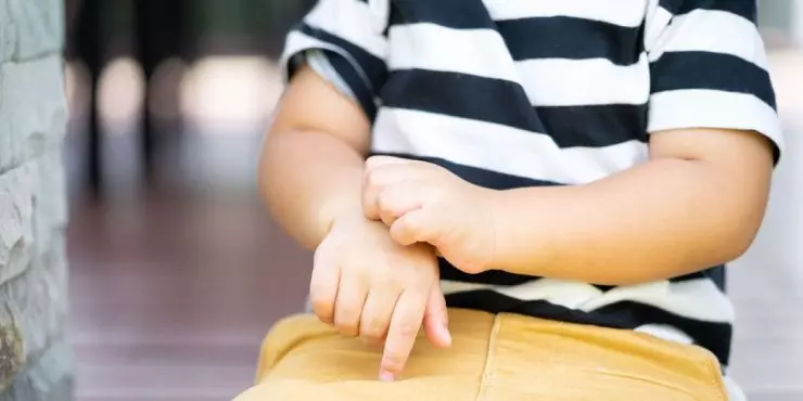 Child Scratching Arm Due to Dry Winter Skin
