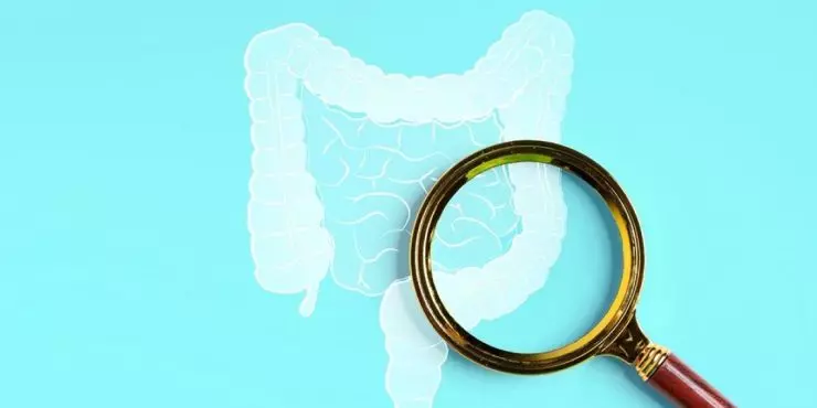 understanding colon cancer screening tests