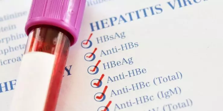 Hepatitis A through E comparison chart from Northwest Family Clinics
