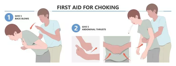 Choking Adult.jpeg
